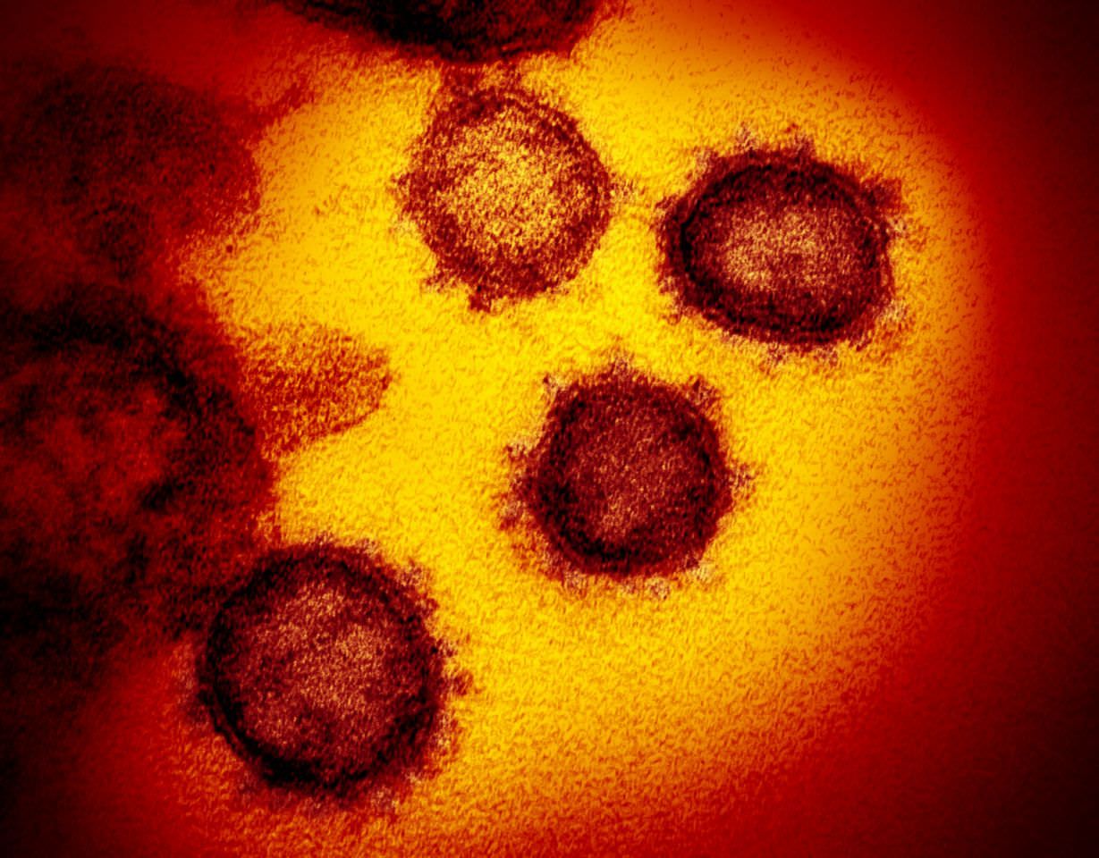 Coronavirus, un solo caso oggi in Calabria. Effettuati 96.902 tamponi