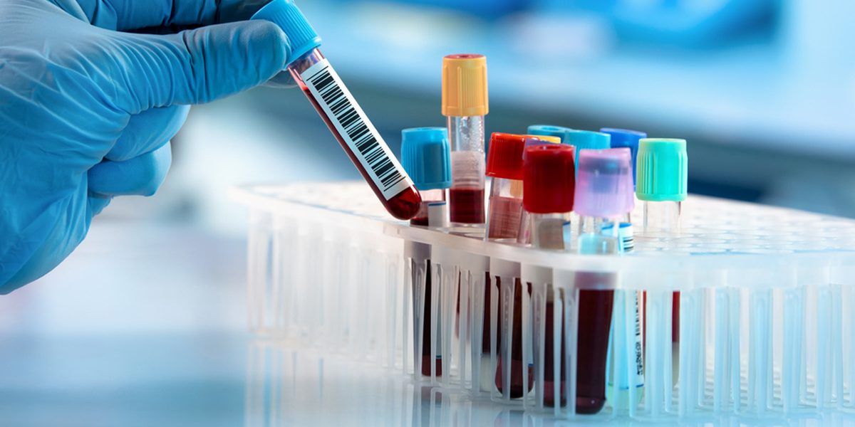 Depressione resistente, un semplice esame del sangue può servire per la terapia