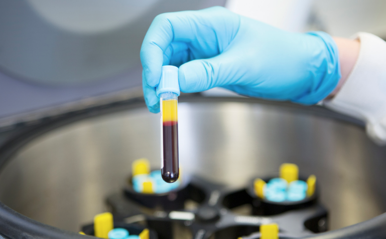 Marito e moglie positivi a Soverato, un matrimonio “sotto osservazione”