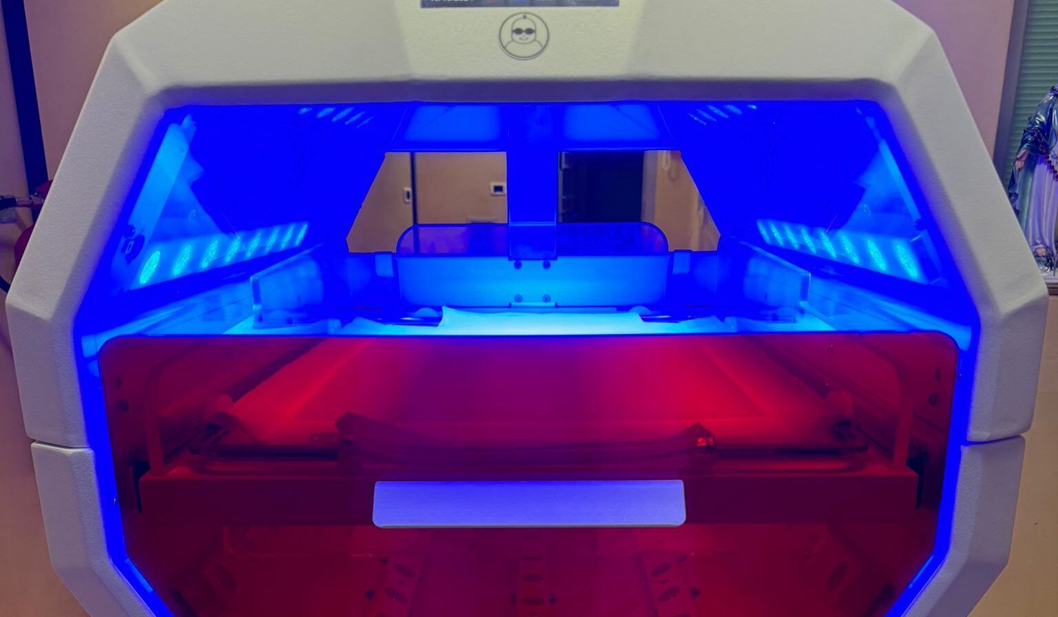 Cosenza, all’Annunziata arriva la culla ad alta tecnologia per i neonati affetti da ittero