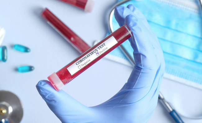 Coronavirus, a Reggio Calabria solo un nuovo caso