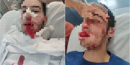 aggressione Emanuele castrolibero