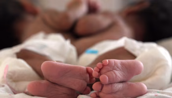 Gemelli a rischio, la corsa da Cosenza a Milano e l’intervento riuscito. Ora sono a casa