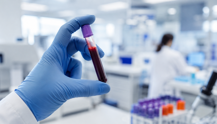 Tumore al colon, un semplice prelievo può individuare le lesioni precancerose