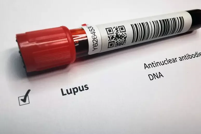 Lupus, tutto quello che c’è da sapere sulla malattia dai mille volti