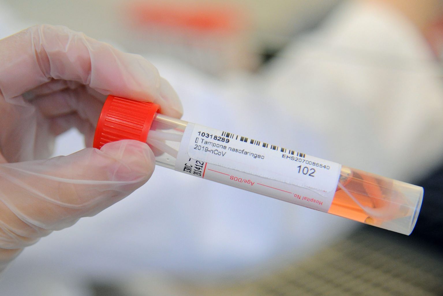 Due decessi e 39 nuovi casi Covid nella provincia di Cosenza