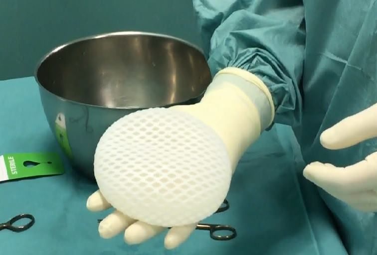 Un calabrese sperimenta una nuova tecnica per la cura del tumore al seno