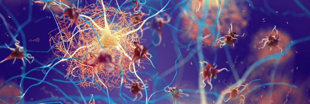 La connettività cerebrale come paradigma per valutare l’efficacia dei farmaci sull’Alzheimer