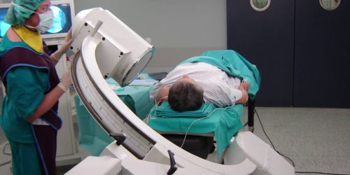 radiofrequenza pulsata asp catanzaro