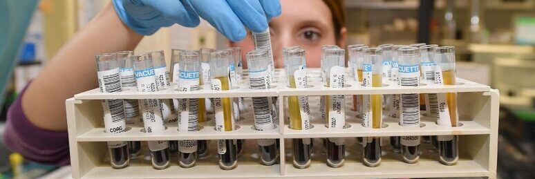 Tumori, la dieta mediterranea “alleata” per la salute