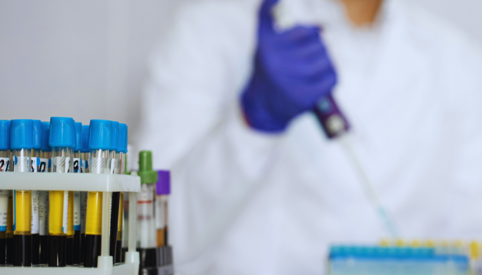 Alzheimer, nuova strategia “smart” potenzia le difese del cervello. Catanzaro tra le università coinvolte