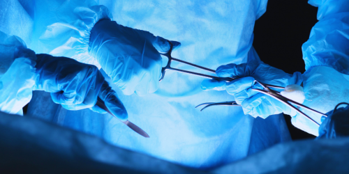 raggio bisturi cancro prostata