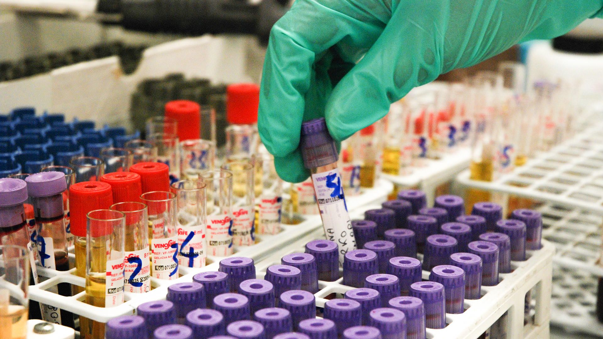 Coronavirus, 16 nuovi contagi nelle ultime 24 ore. Aumentano i guariti