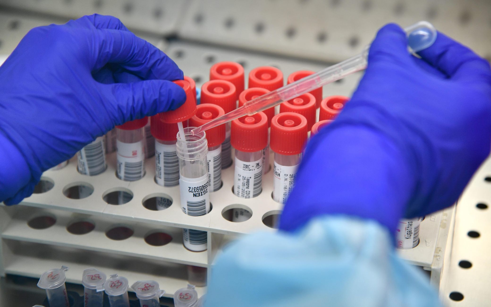 Covid a Reggio Calabria, dubbi sulla validità dei test rapidi