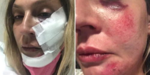 pestata donna Tortora