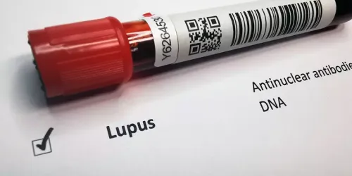 Lupus