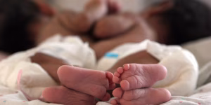 Gemelli a rischio, la corsa da Cosenza a Milano e l’intervento riuscito. Ora sono a casa