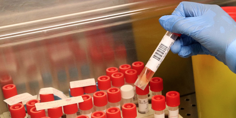 Coronavirus, 302 nuovi positivi e quattro decessi oggi in Calabria – GRAFICO