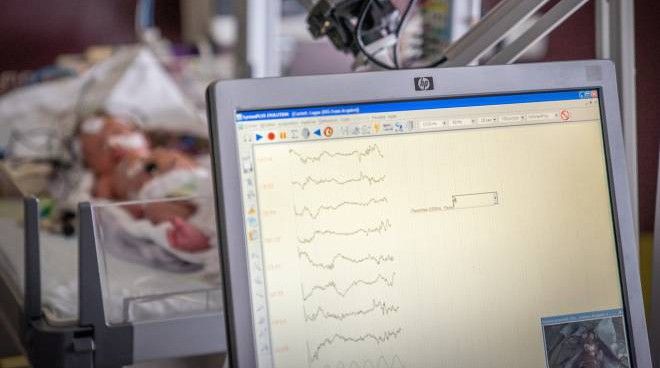 Covid, migliora (ma è ancora critica) la bimba di 7 mesi