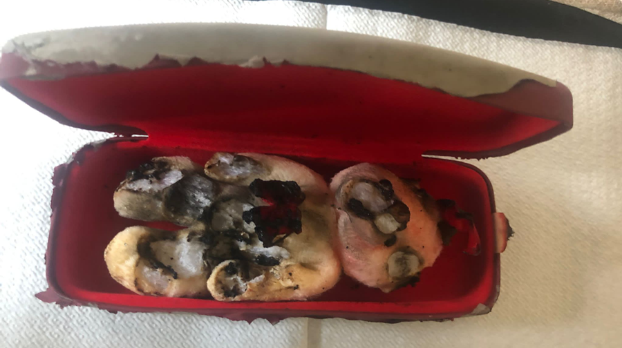 Corigliano Rossano, intimidazione al consigliere comunale Francesco Madeo. «Non mi farò influenzare»