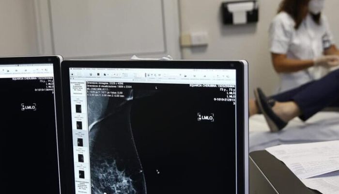 Cancro al seno, dall’Aifa via libera alla rimborsabilità di ribociclib in adiuvante