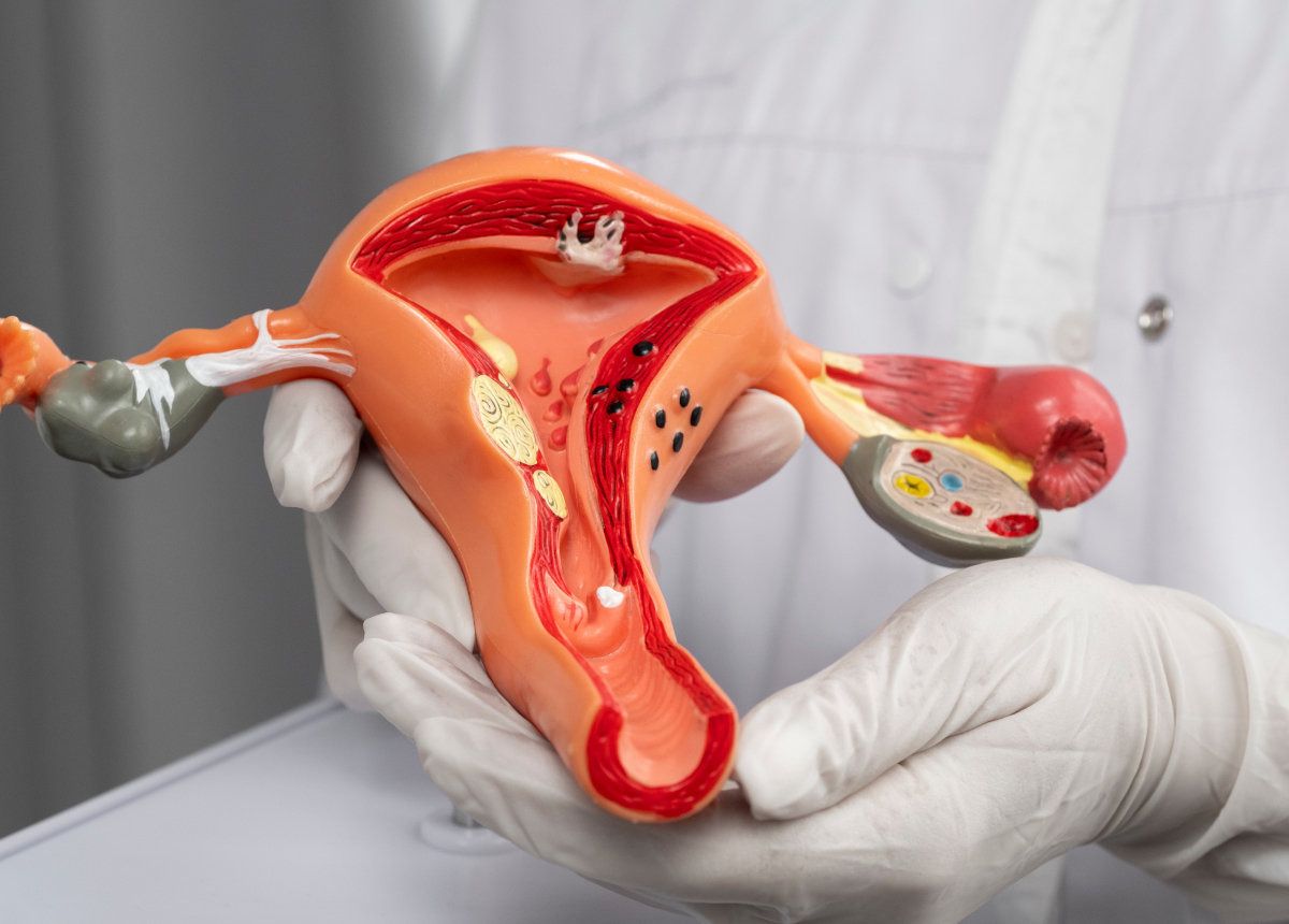 Endometriosi, in Italia colpite 3 milioni di donne: oltre 7 anni per la diagnosi