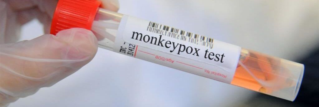 Vaiolo delle scimmie, ecco il piano dell’Oms. Ma servono 135 milioni di dollari
