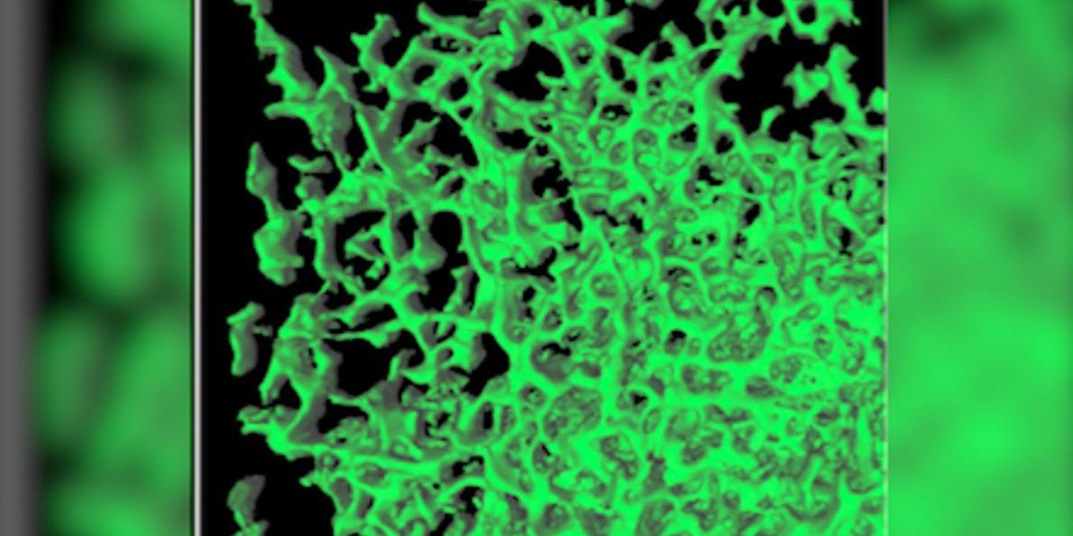 Forma del cancro svelata in tre dimensioni: la struttura nascosta delle metastasi