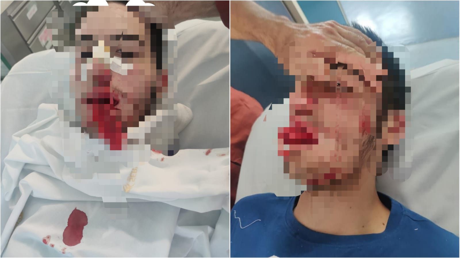 Giovane pestato a Castrolibero, l’appello dell’avvocato della famiglia: «Chi sa parli»