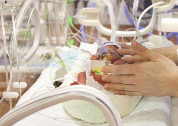 Ospedale Annunziata, dimessa la bimba prematura affetta da perforazione intestinale