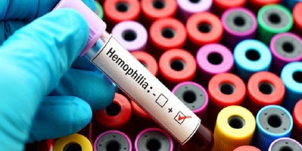 Emofilia, arriva in Italia il nuovo farmaco concizumab: svolta nella profilassi