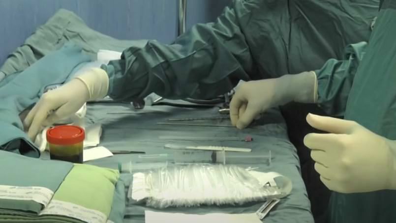 Innovativo intervento chirurgico all'Annunziata di Cosenza