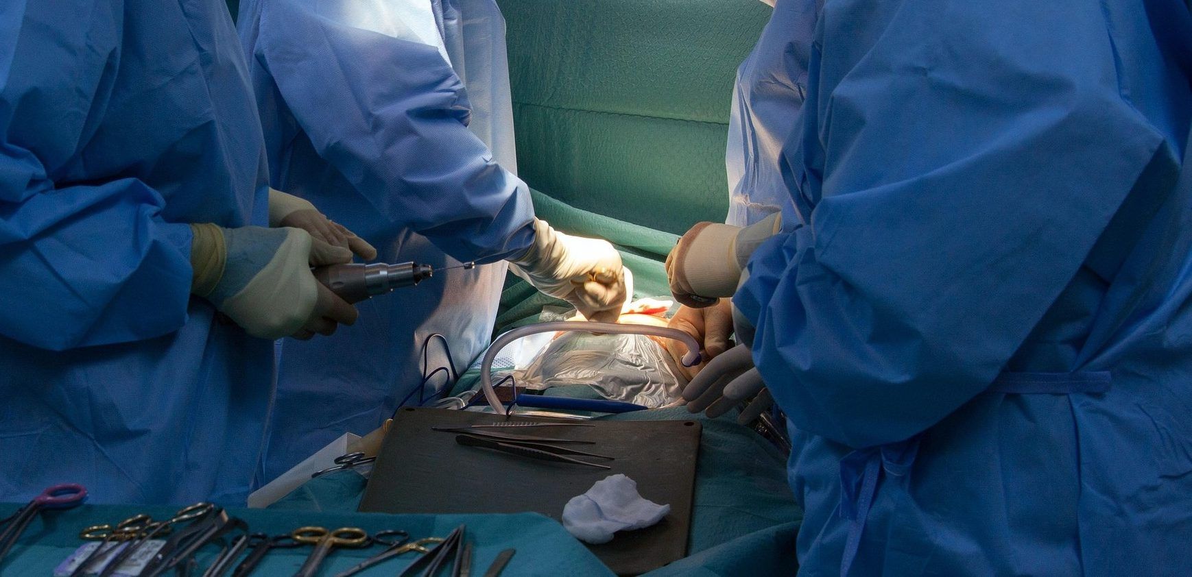 Tumore al cervello, l’Italia guida la ricerca con SeqPerGlio