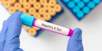 Epatite A, dati in aumento in tutta Italia: segnalati casi anche in Calabria