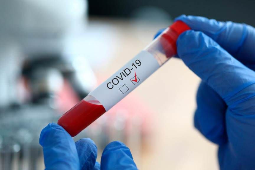 Coronavirus, il bollettino: 1.069 i positivi (+9). Le persone guarite sono 170