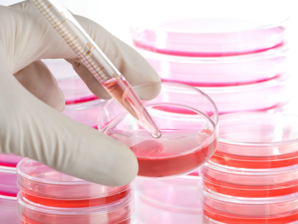 Metodo Stamina, muore bimba calabrese