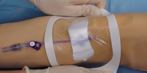 Niente cateteri, a Corigliano-Rossano chemioterapia a rischio per i malati oncologici