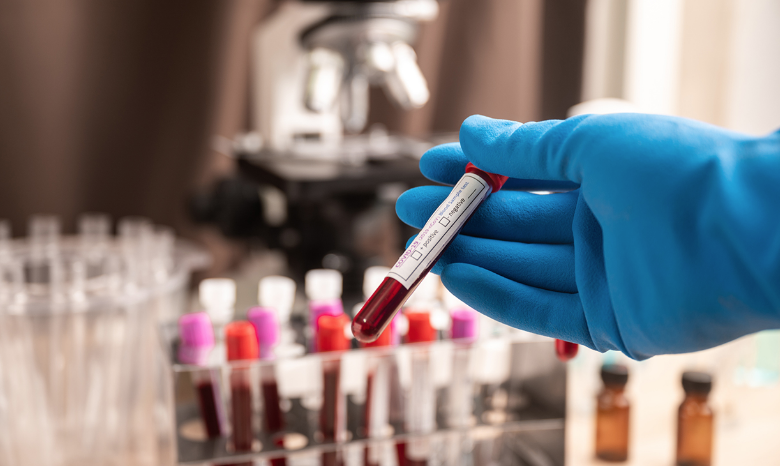 Coronavirus, positivi ancora in crescita. Undici nuovi contagi in Calabria