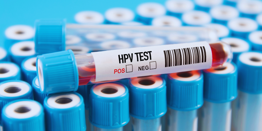 Hpv, 7.500 tumori l’anno in Italia