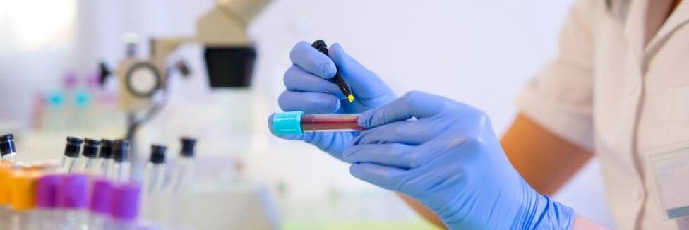 Scoperto un nuovo meccanismo della leucemia acuta infantile