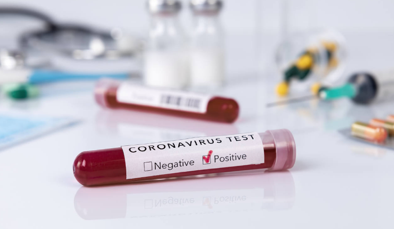 Coronavirus, crescono i positivi in Calabria: +4 rispetto a ieri. I guariti sono 356