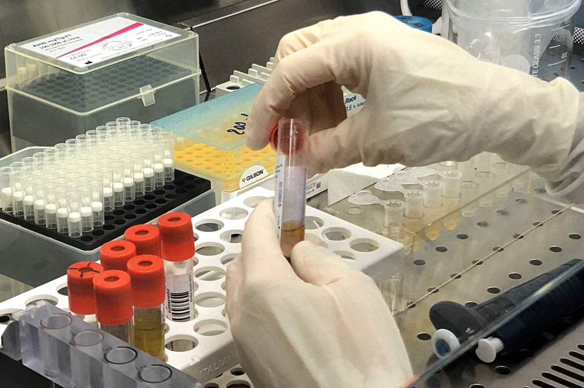 Covid-19, altri due casi positivi a Santa Maria del Cedro