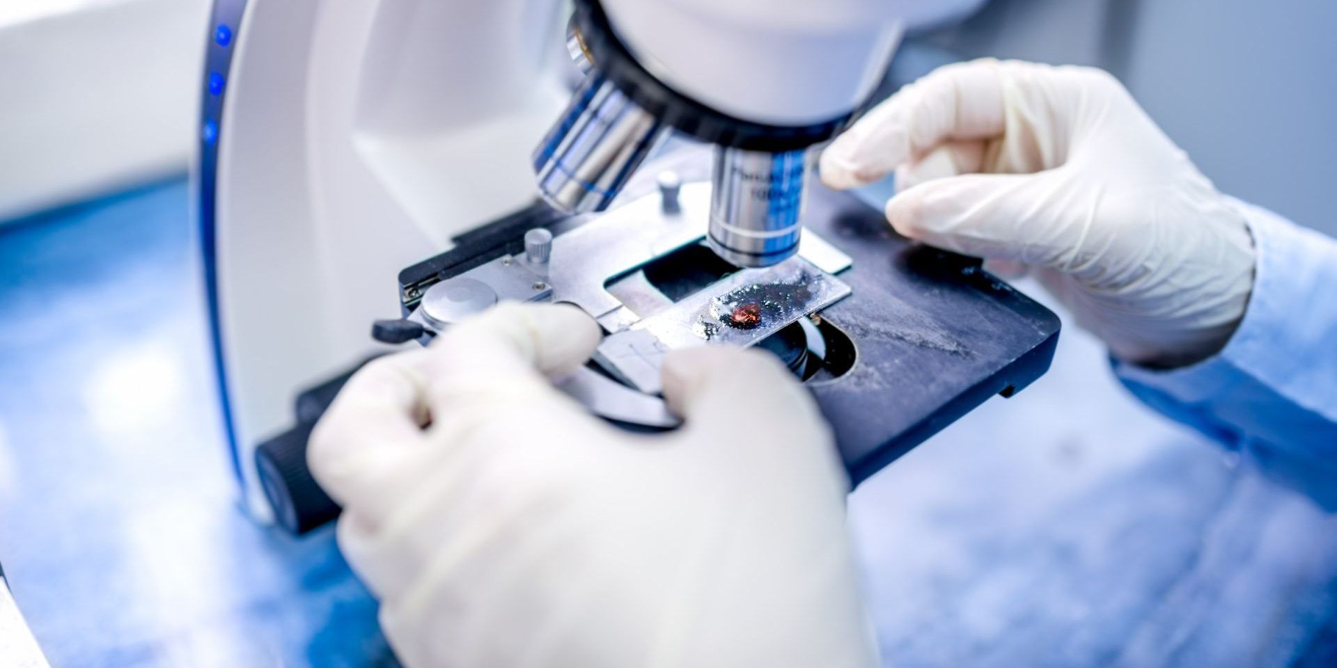 Tumore del retto, in un caso su quattro si può guarire senza chirurgia