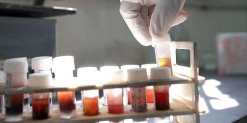 Trasmise l'Aids alla compagna che morì, condannato a 22 anni