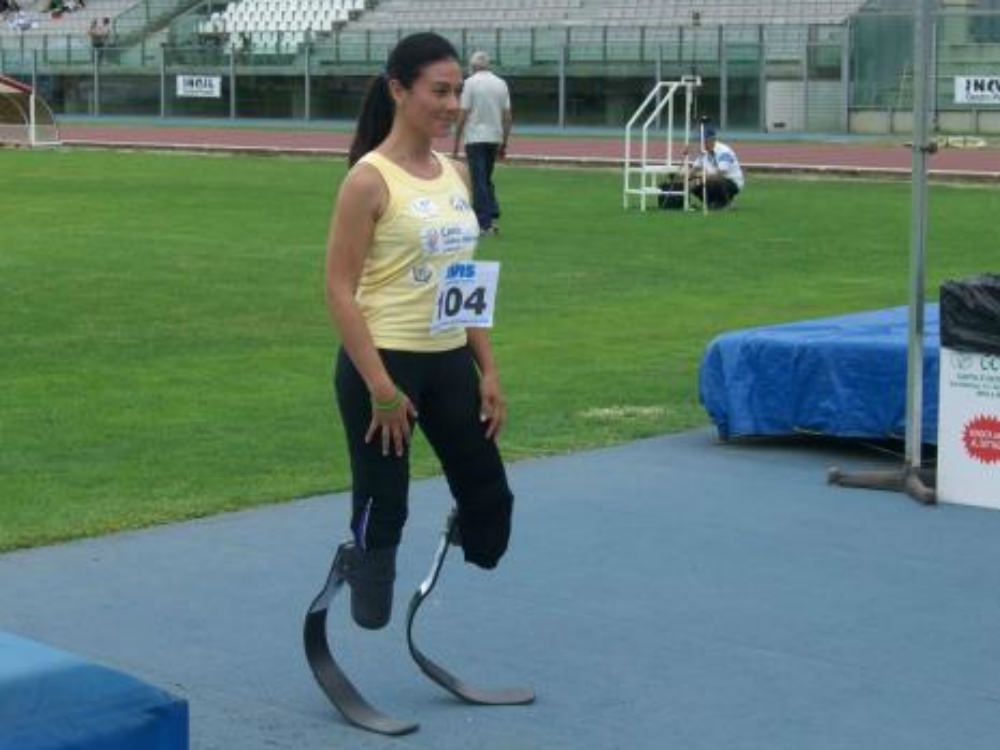 Versace: «La disabilità non è una vergogna»