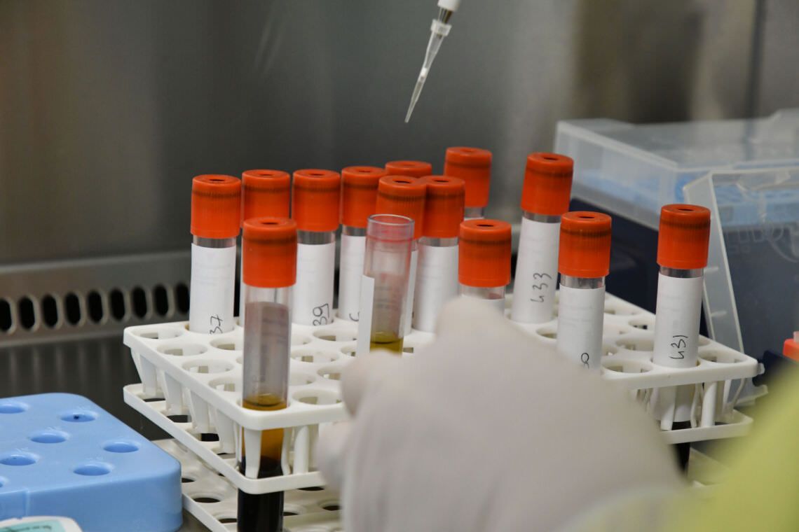 Curinga, registrato un nuovo caso di positività al Covid-19