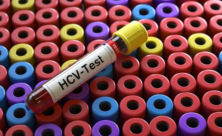 Epatite C, al via nelle carceri lo screening su sangue capillare