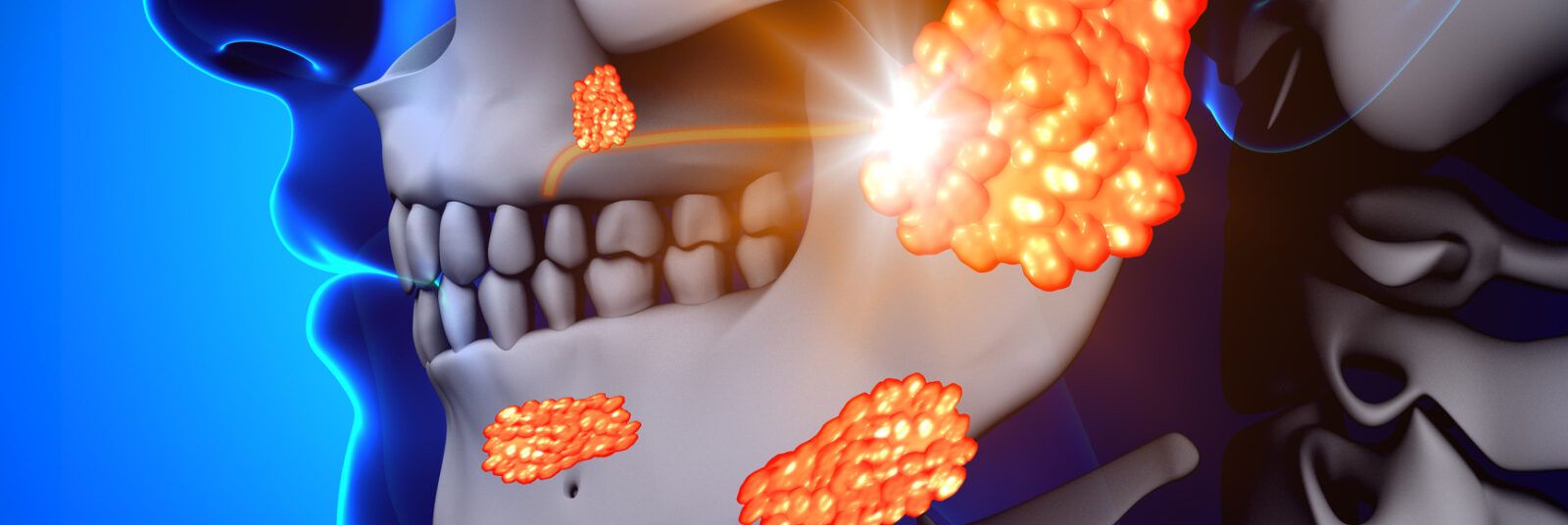 In Italia ogni anno vengono diagnosticati 4.000 casi di tumori alla bocca