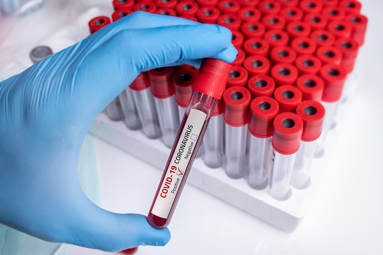 Coronavirus, in Calabria altri 239 positivi. Sono 2.950 i casi attivi