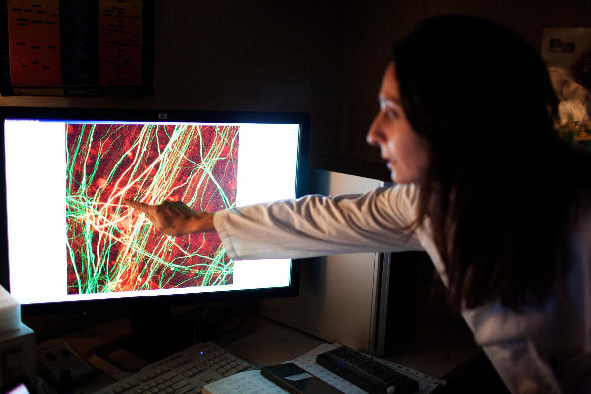 Sanità, 100 giovani con sclerosi multipla a confronto a Pizzo